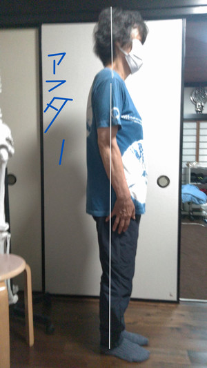 7_5