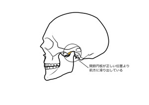23579043